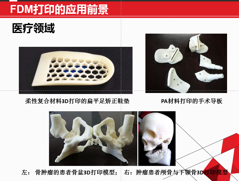 FDM 技術(shù)3D打印機應(yīng)用領(lǐng)域廣泛，在可預(yù)見的未來無可估量！
